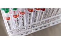 DSÖ: Avrupa'da son 2 haftada maymun çiçeği vakaları üçe katlandı