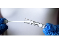 Sağlık Bakanlığı PCR ve antijen test merkezlerinin çalışma saatlerini açıkladı