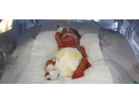 Tekirdağ'da 23 haftalık doğan bebeğe kök hücre nakli yapıldı