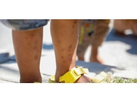 İstanbul'da 'Aedes' türü sivrisineklerde artış var