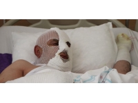 Tıkalı lavaboya kimyasal ürün döken adamın vücudu yandı