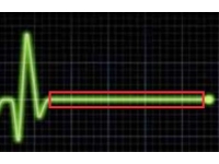 Akdoğan’da feci olay! Elektrik akımına kapılarak hayatını kaybetti