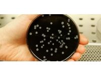 Arjantin'de bir klinikte legionella bakterisinin yol açtığı zatürreden 6 kişi öldü