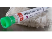 Ürdün'de ilk maymun çiçeği vakası tespit edildi