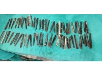 Karnı ağrıyan adamın midesinden 60'tan fazla kaşık çıkarıldı