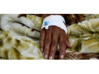 Nijerya'da kolera salgınında ölenlerin sayısı 382'ye yükseldi