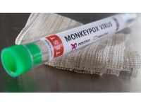 Tabipler Birliği’nden Maymun Çiçeği (mpox) hakkında açıklama