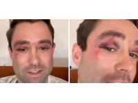 New York metrosundaki şiddetin son kurbanı TV sunucusu oldu