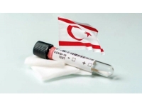 Son iki haftada 106 kişinin koronavirüs testi pozitif çıktı