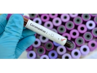 Sağlık Bakanlığı 1-14 Mart arasında 2 bin 729 Covid-19 testi yapıldığını 171 vakaya rastlandığını açıkladı