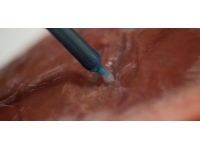 İnsan vücudunda 3 boyutlu organ yazdırma dönemi