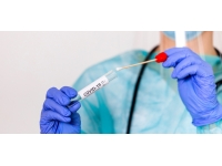 Sağlık Bakanlığı: Son iki haftada 120 Kovid-19 vakası tespit edildi