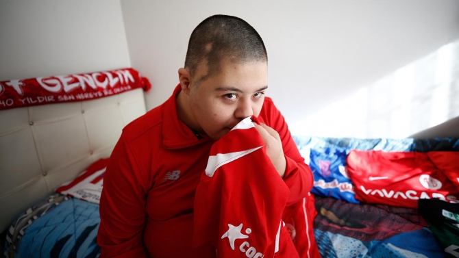 Down sendromlu Gültekin'in kalbi "Antalyaspor" ile atıyor